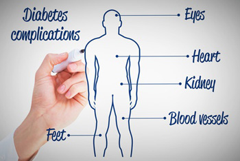 Diabetes: DRG Kodierung